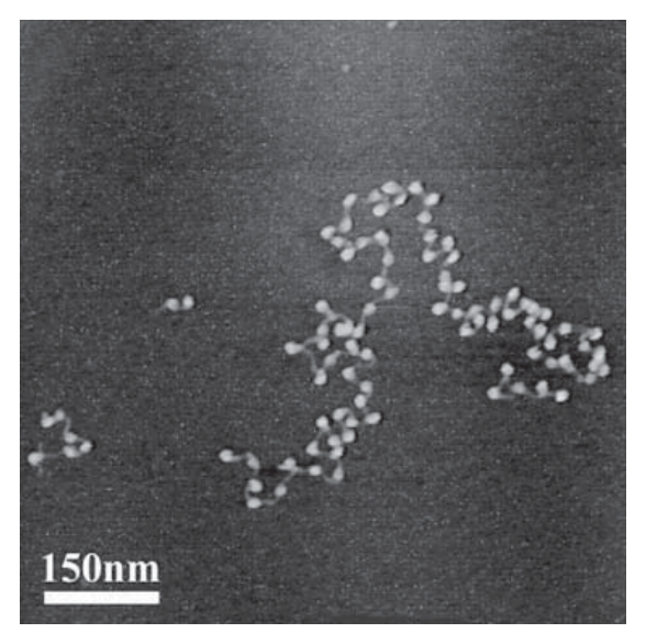 Electron micrograph of nucleosomes β the dense spherical particles, about 10 nm across, strung along DNA filaments