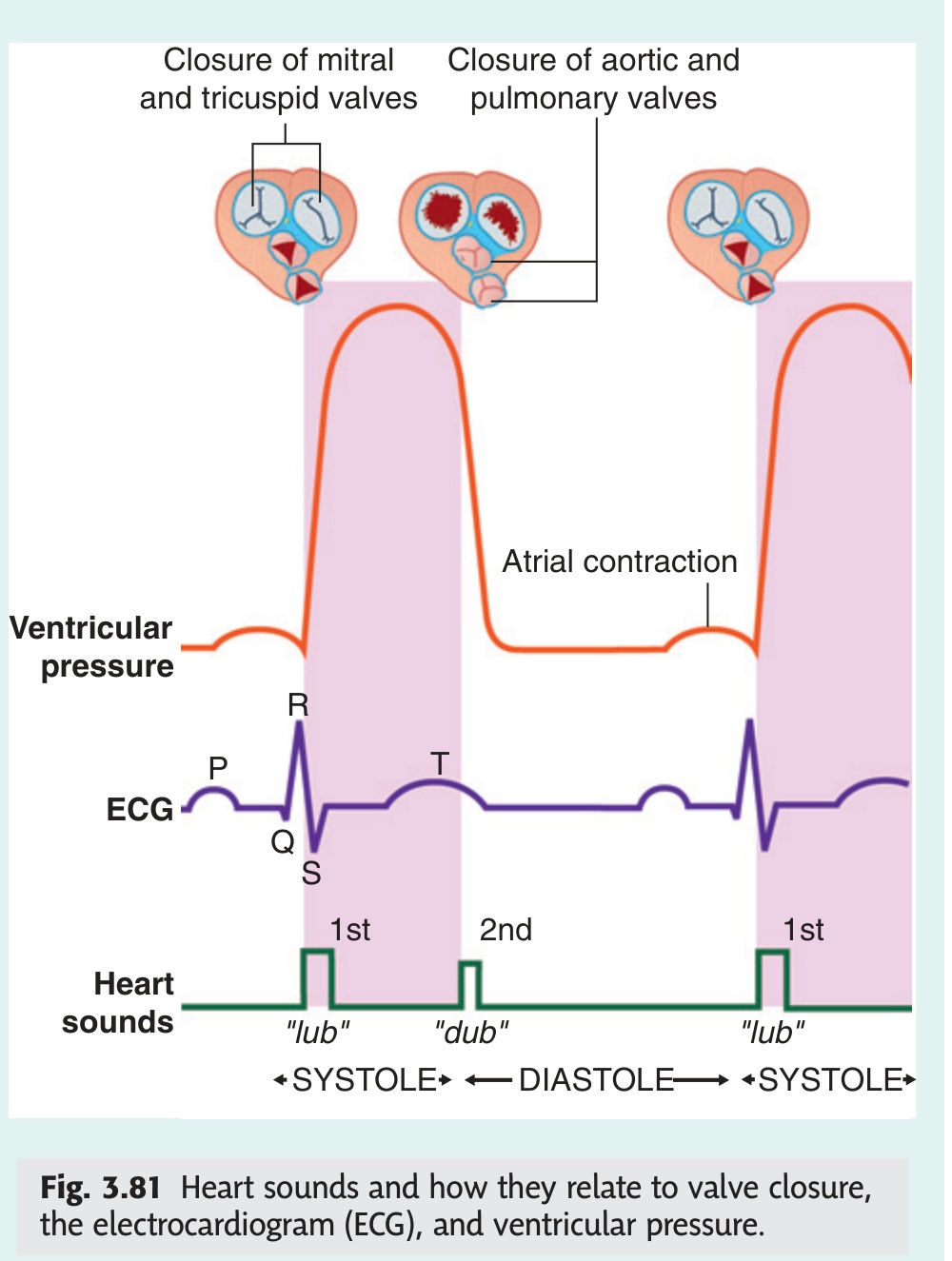Cardiac auscultation – valve closure timing and positions (Gray's Fig 3.81)