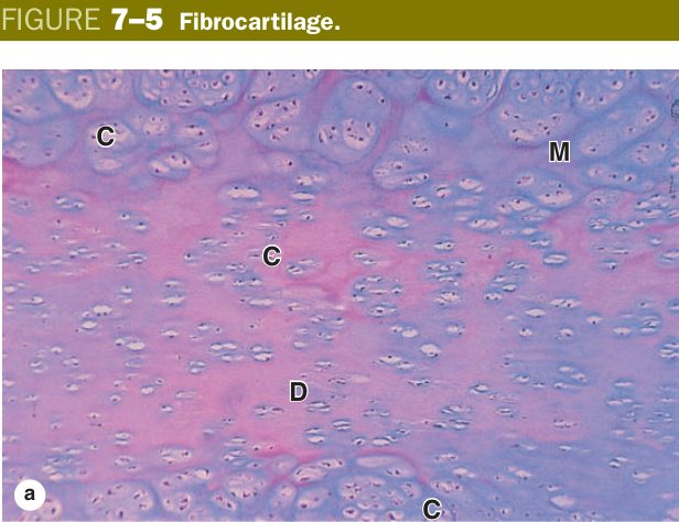 Fibrocartilage