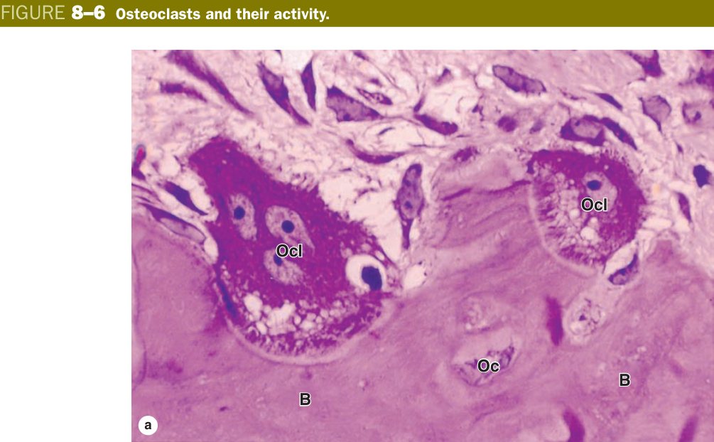 Osteoclast