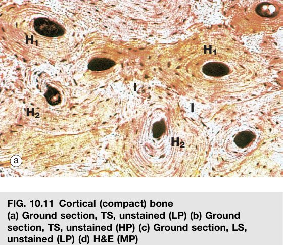 Compact bone Wheater's