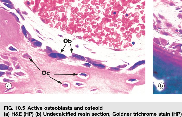 Osteoblasts Wheater's