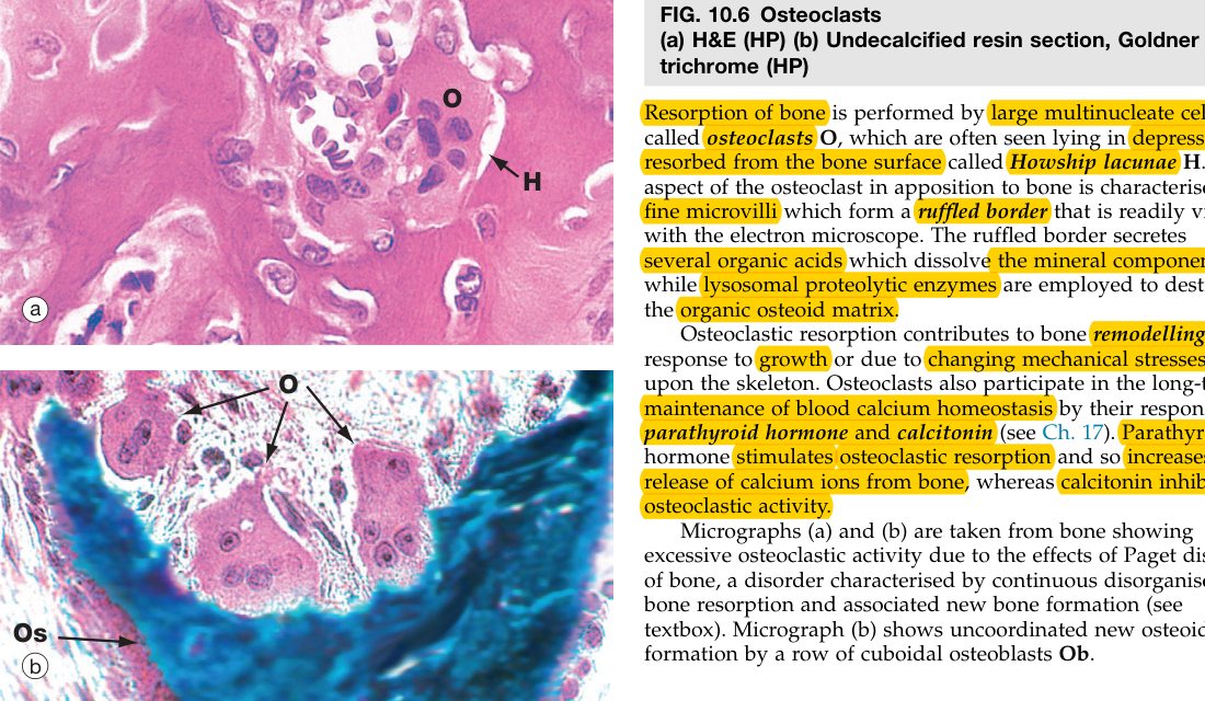 Osteoclasts Wheater's