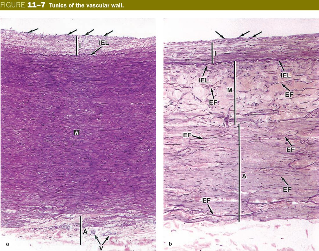 Tunics of vascular wall