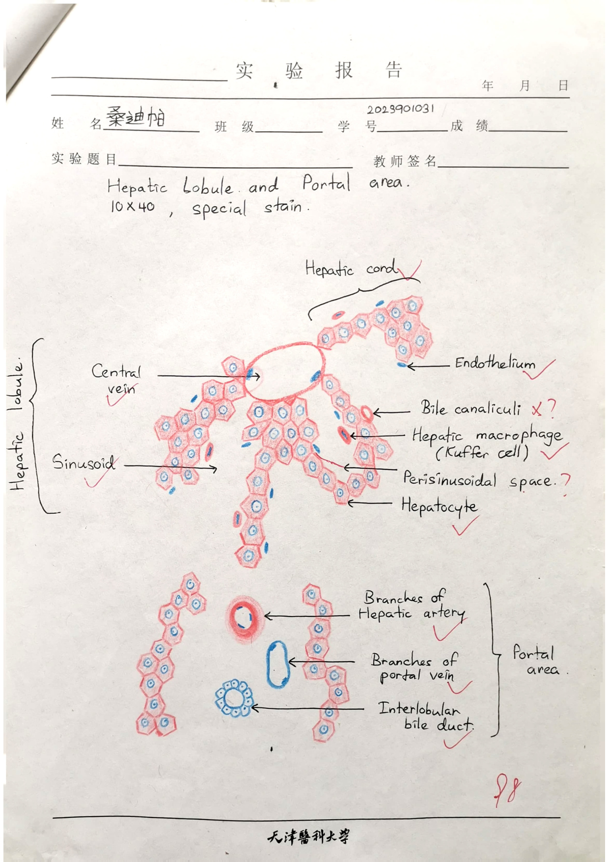 Hepatic lobule labelled drawing