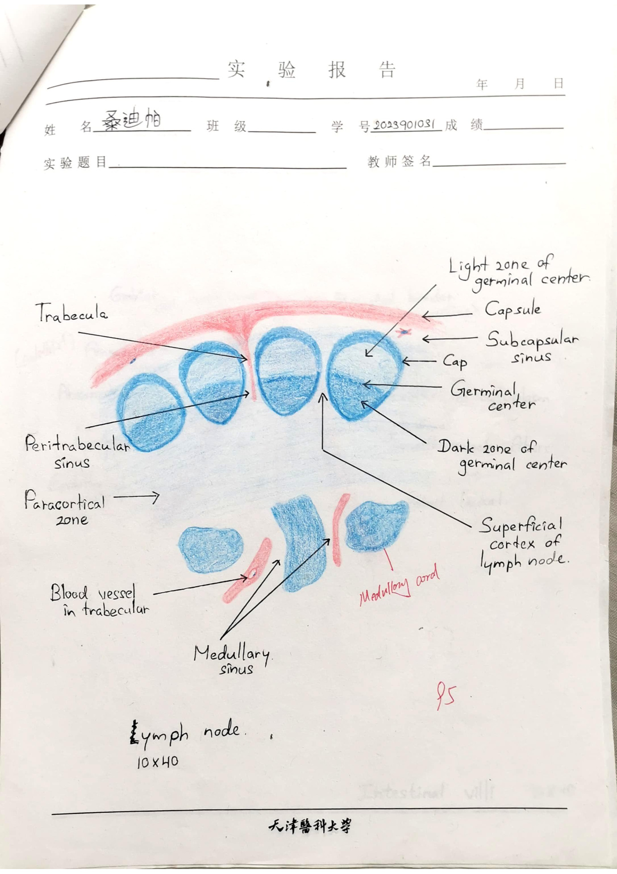 Lymph node labelled drawing