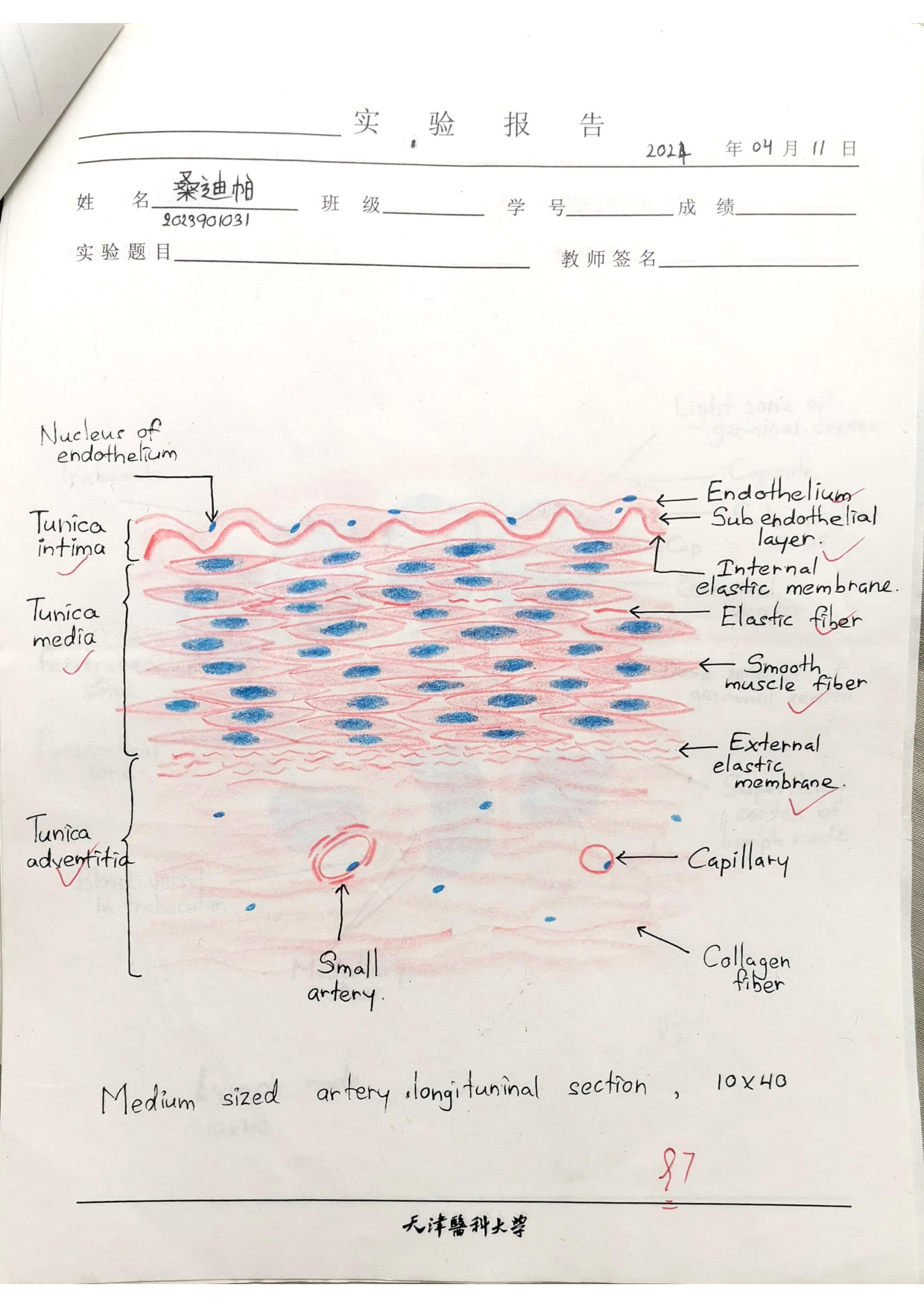 Medium artery LS drawing