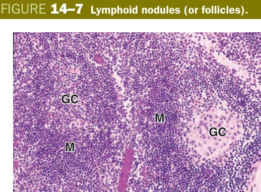 Lymphoid nodule