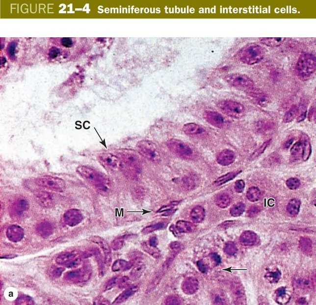 Seminiferous tubule and interstitial cells