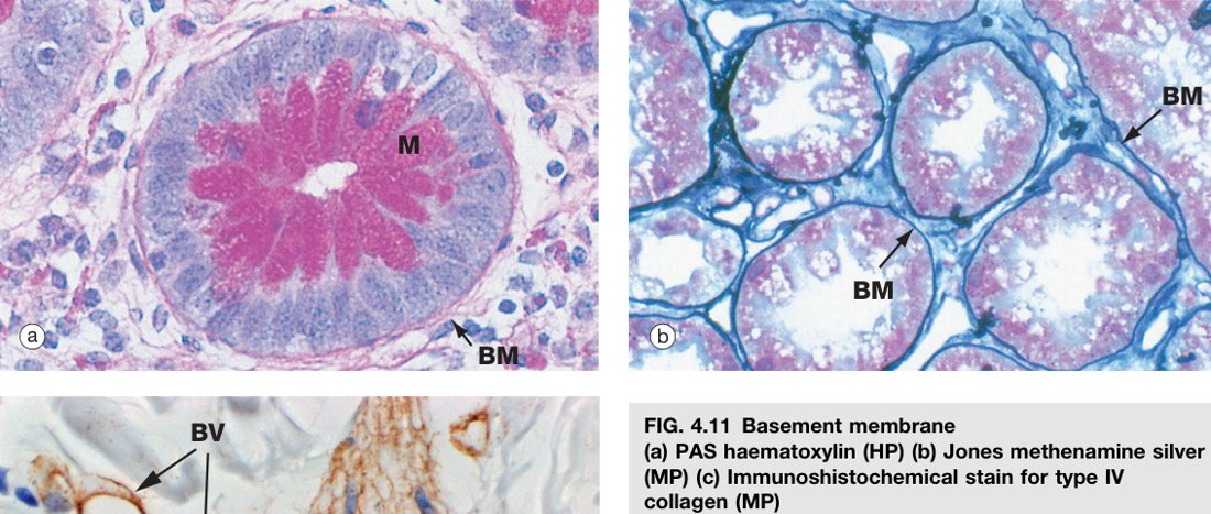 Basement membrane PAS