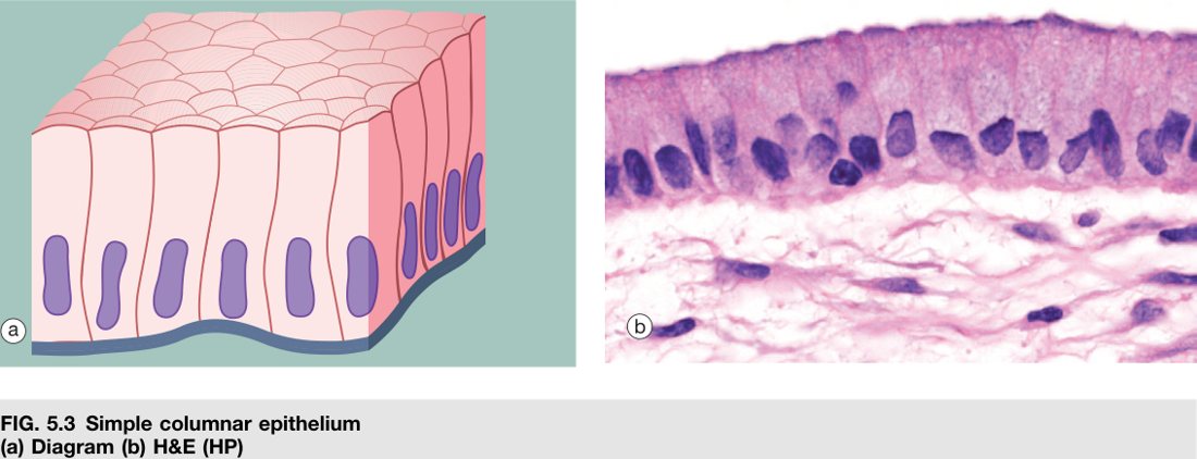 Simple columnar