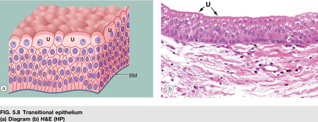 Transitional epithelium