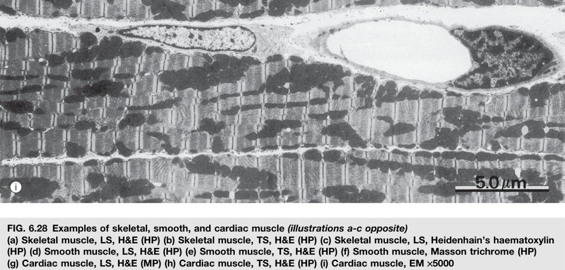 Three muscle types compared