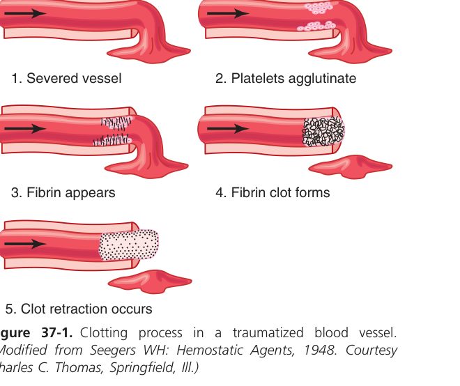 Clotting in a traumatised vessel (Guyton Fig 37-1)