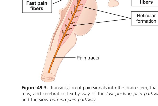 Pain transmission pathway (Guyton Fig 49-3)