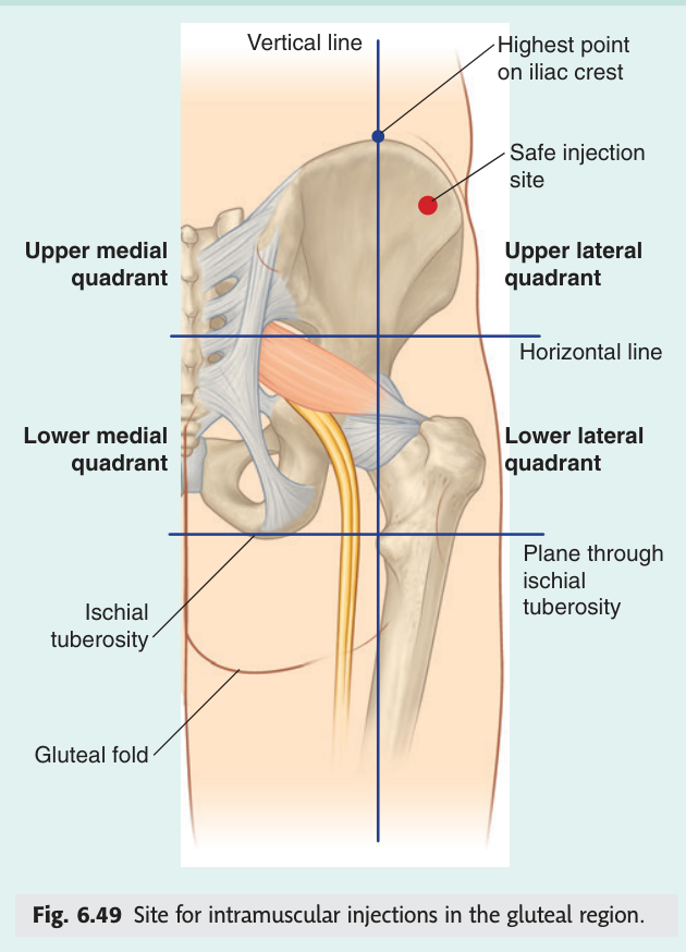 Site for intramuscular injection in the gluteal region