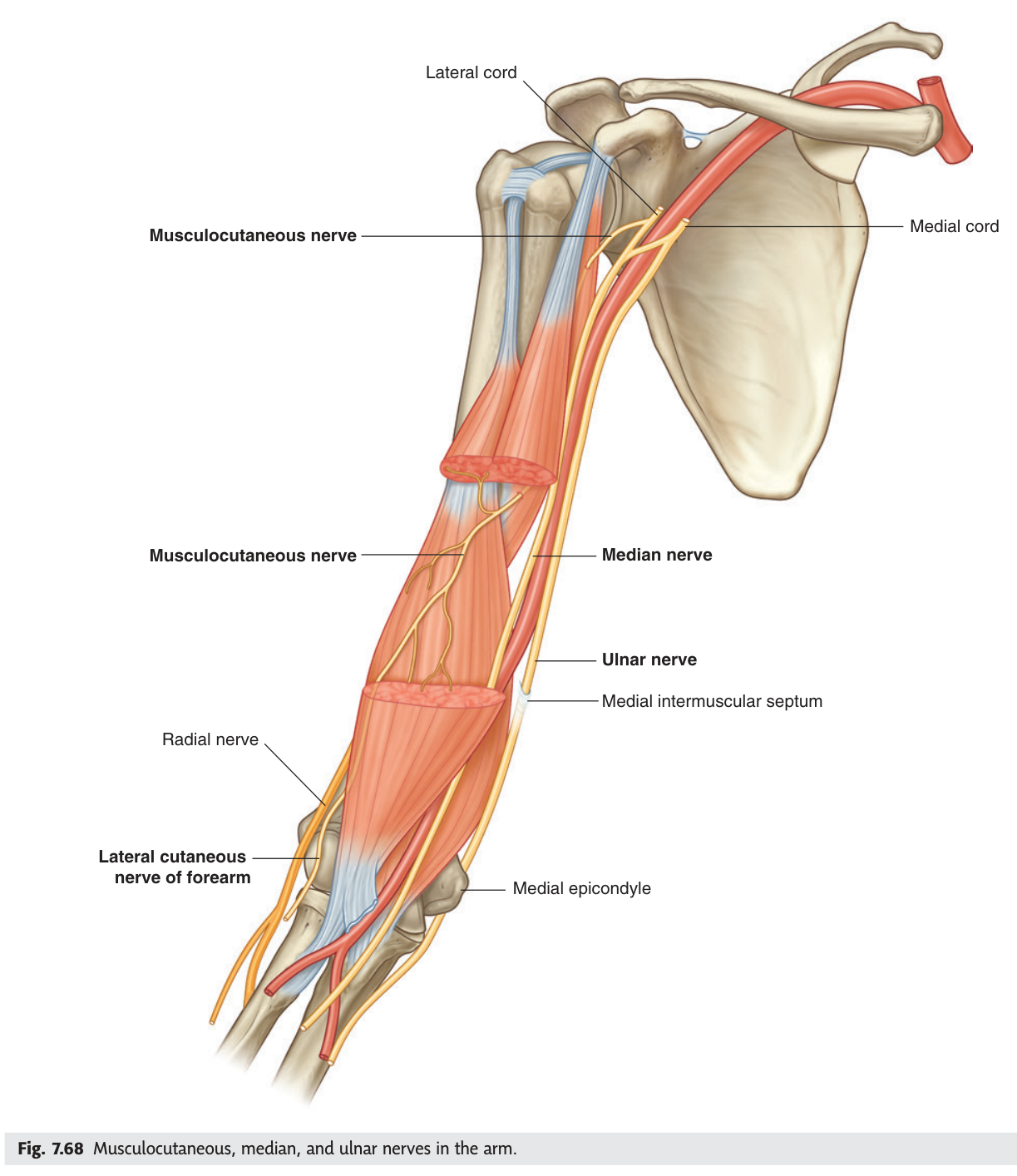 Musculocutaneous, median and ulnar nerves in the arm, with the brachial artery.