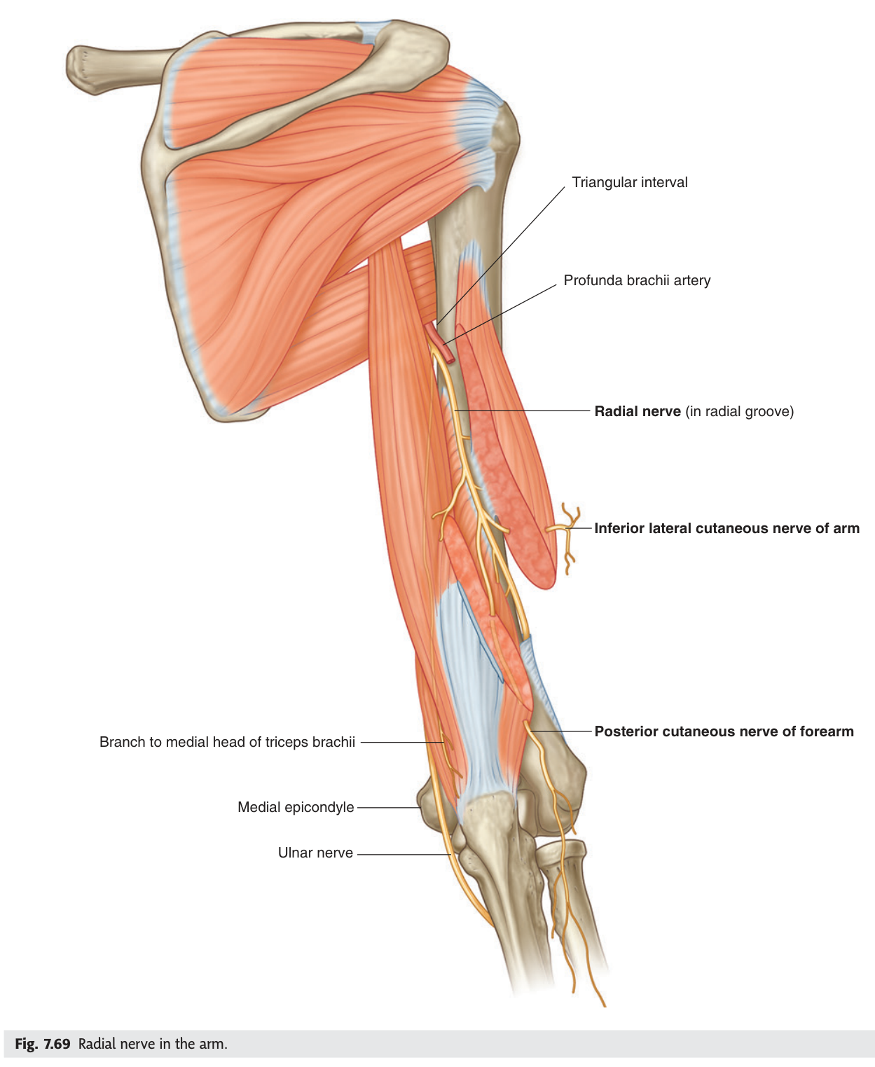 The radial nerve in the radial (spiral) groove, passing between the heads of triceps with the profunda brachii artery.