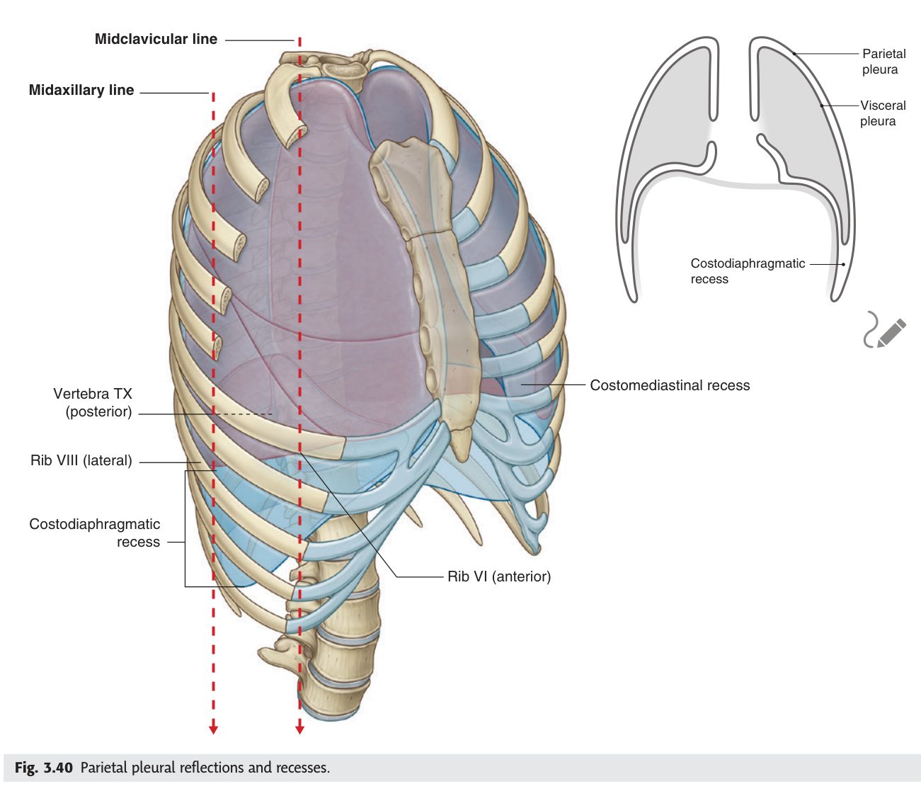 Pleural reflections and recesses. The lung (blue) does not reach the lowest limit of the pleural cavity (purple) โ that gap is the costodiaphragmatic recess.