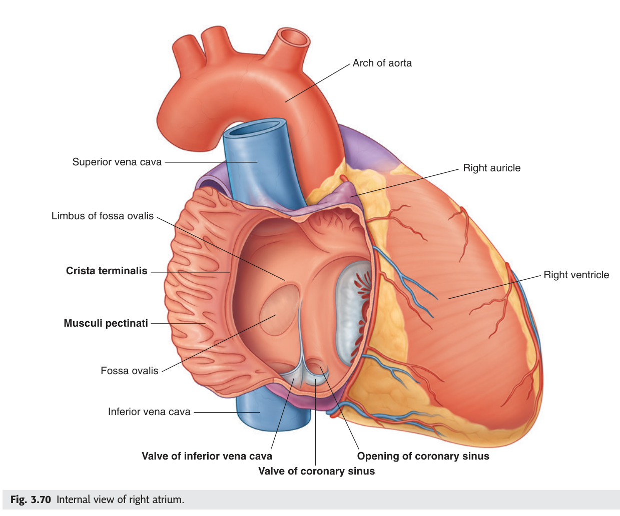 Interior of the right atrium: crista terminalis, musculi pectinati, fossa ovalis, and the three inlets.