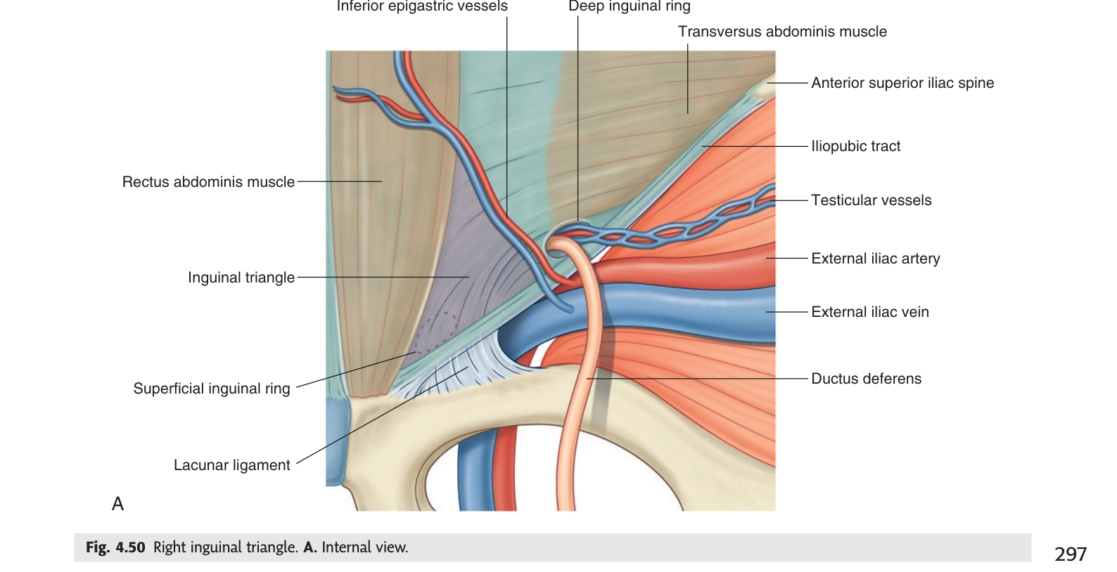 The right inguinal triangle seen from inside the abdomen: bounded by the inferior epigastric vessels laterally, rectus abdominis medially and the inguinal ligament below.