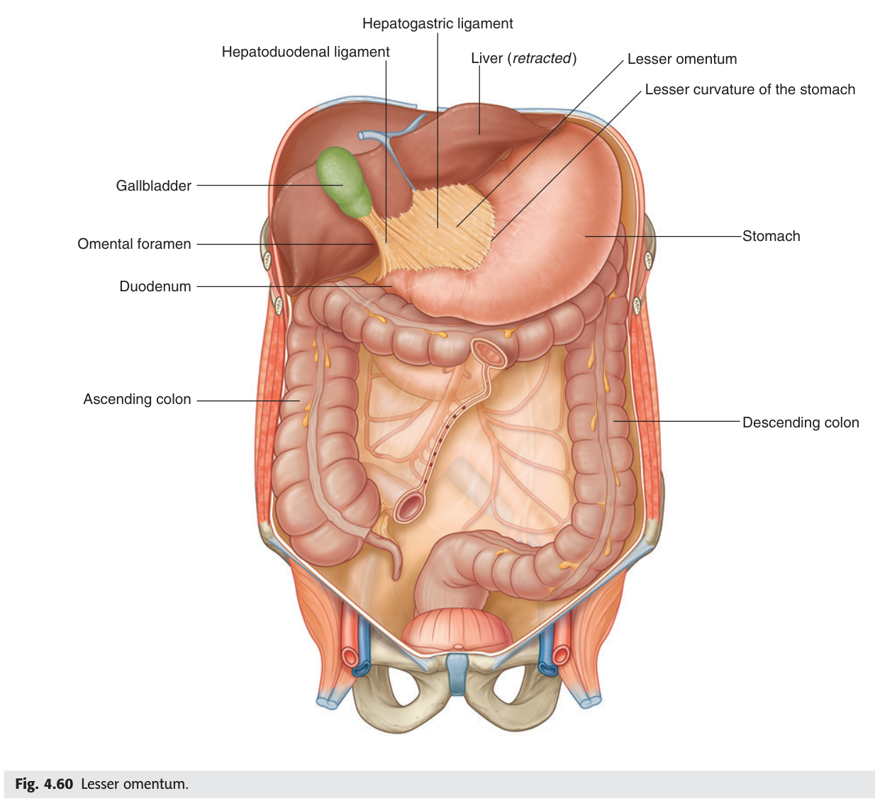 The lesser omentum with its hepatogastric and hepatoduodenal parts; the omental (epiploic) foramen lies behind its free edge.