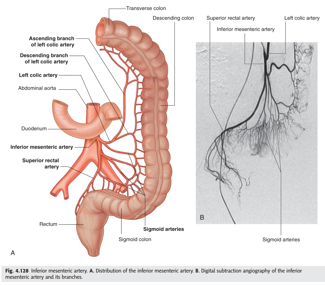 Distribution of the inferior mesenteric artery: left colic, sigmoid and superior rectal branches.