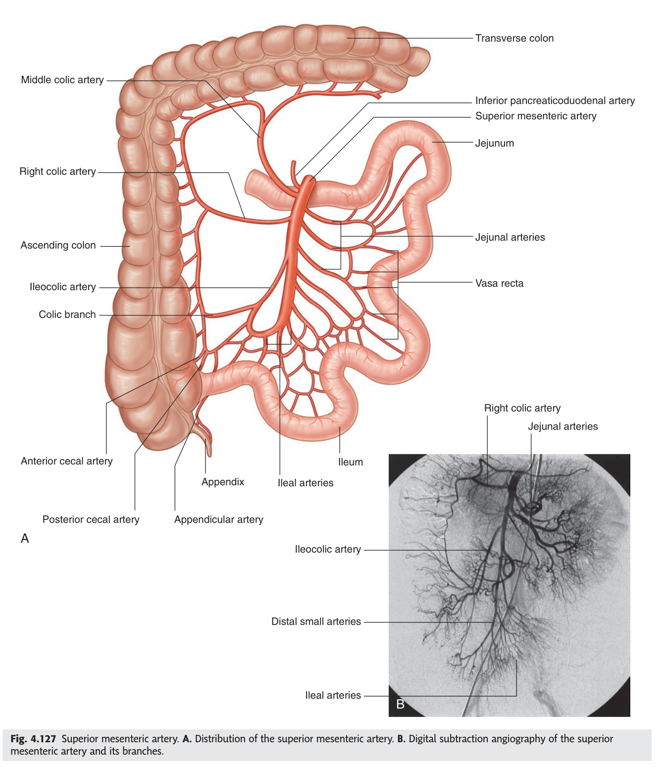 Distribution of the superior mesenteric artery β jejunal and ileal branches to the left, colic branches to the right.