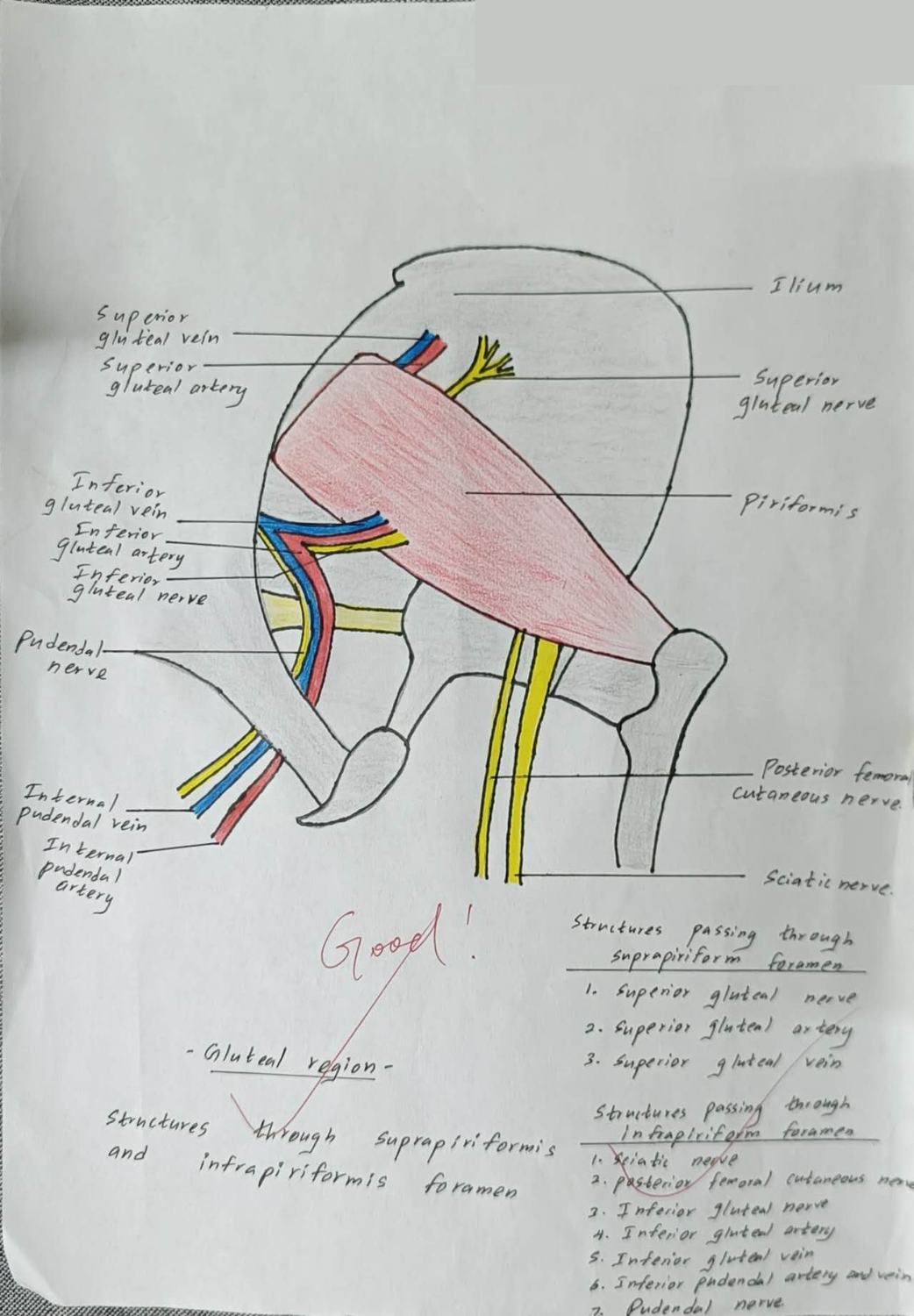 Suprapiriform and Infrapiriform Foramina — TMU dissection drawing