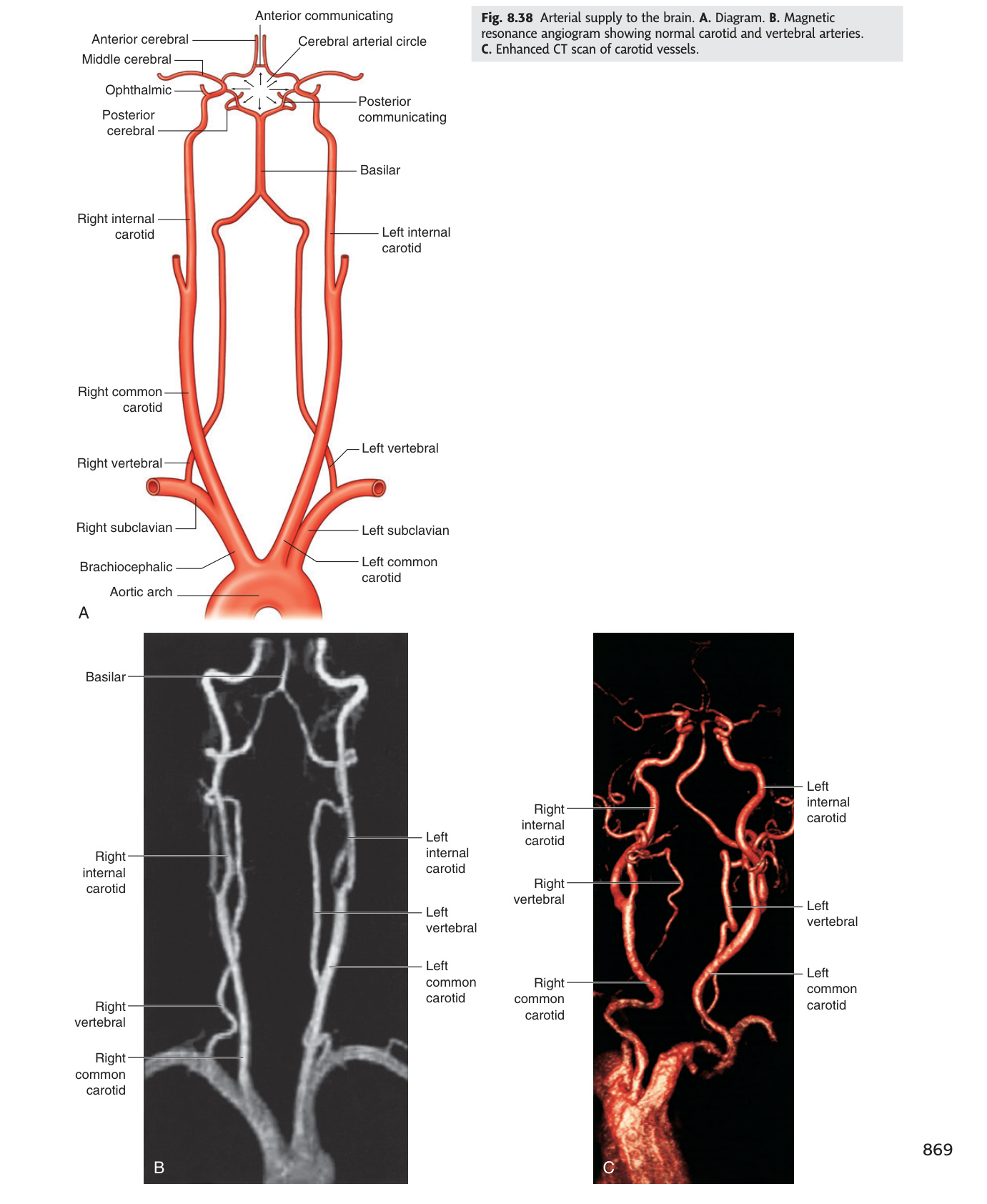 Arterial supply to the brain — circle of Willis