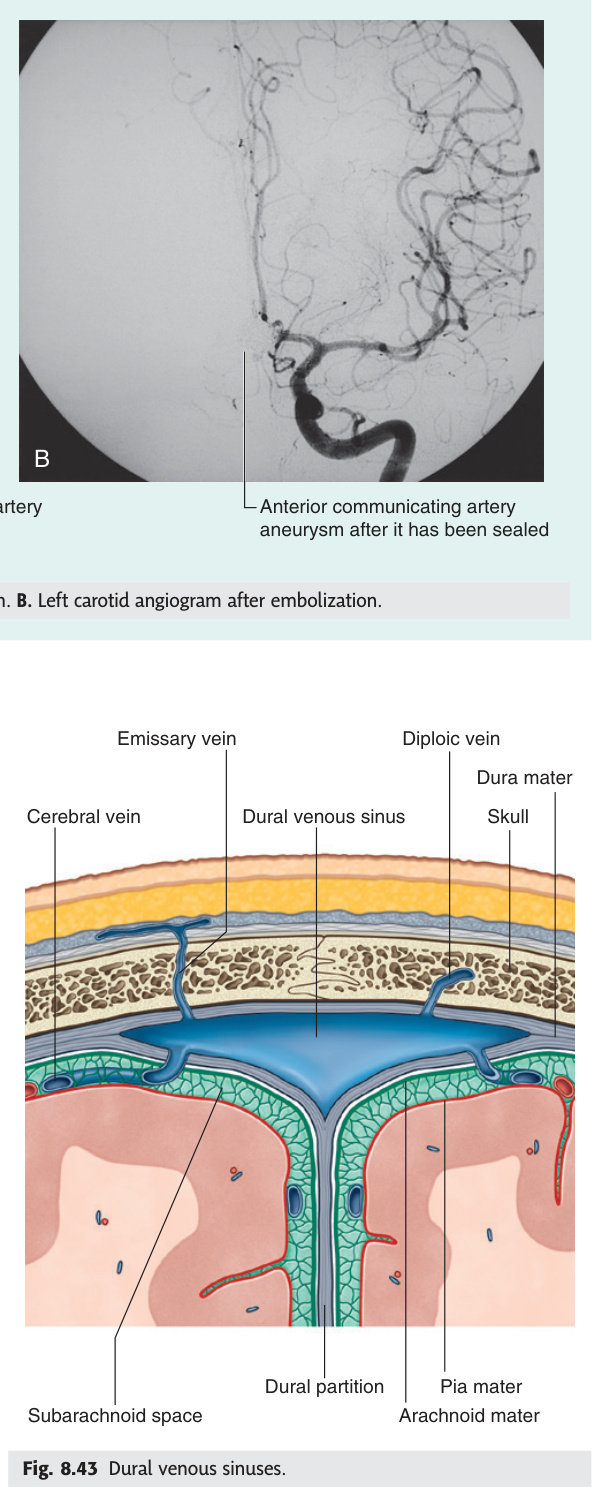 Dural venous sinuses