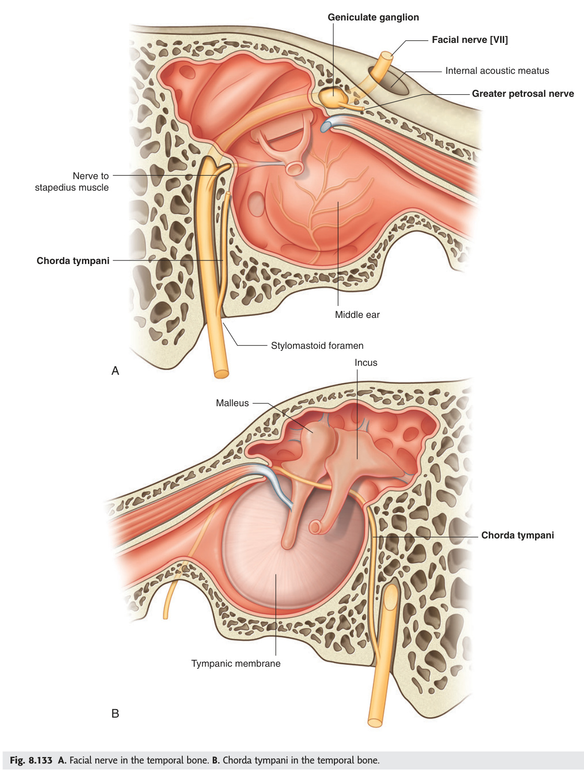 Facial nerve in the temporal bone
