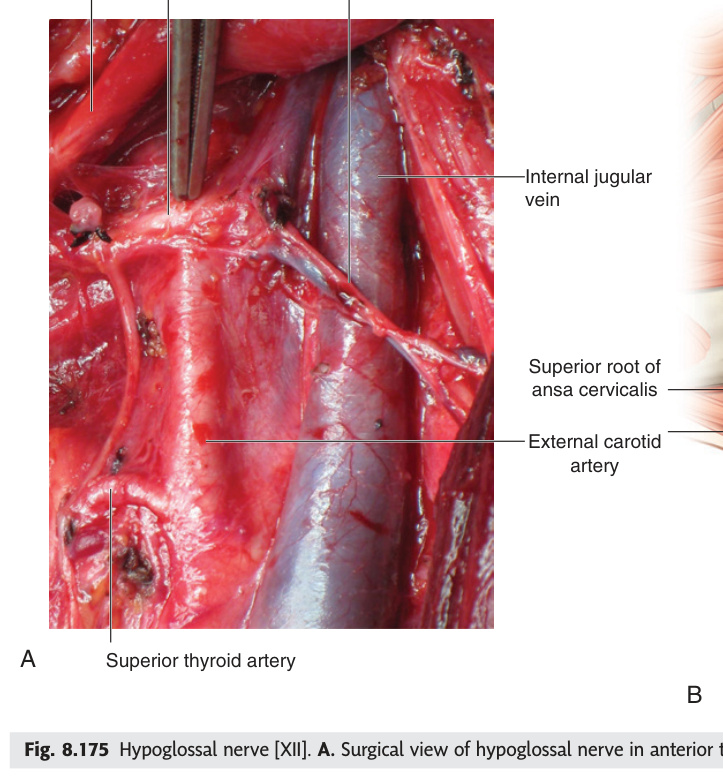 Hypoglossal nerve in the neck